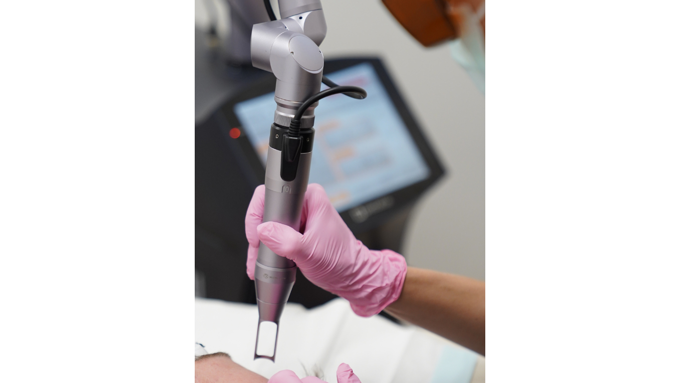 Laser Tattoo Removal