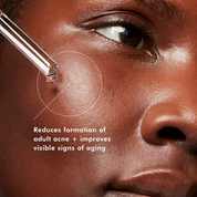 Blemish & Age Serum