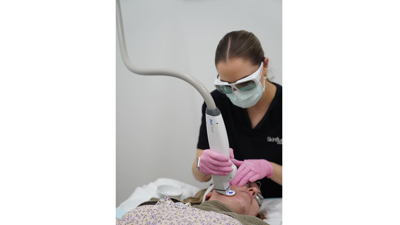 AviClear Laser