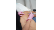 Lesion Removal