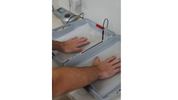 Iontophoresis